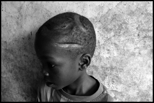RDC - dans un orphelinat, un enfant survivant aprè