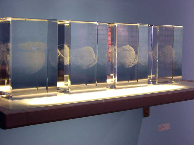 Pregnant - SCP, Kansas City, MO 2006