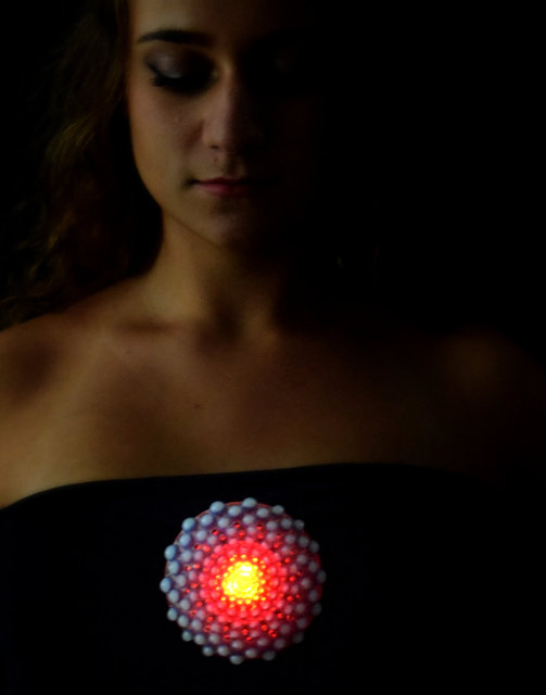 Zoa