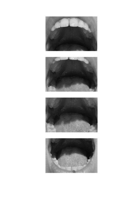 teethbw (1).jpeg