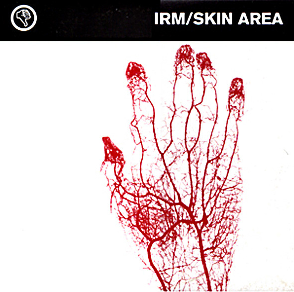 IRM / Skin Area EP