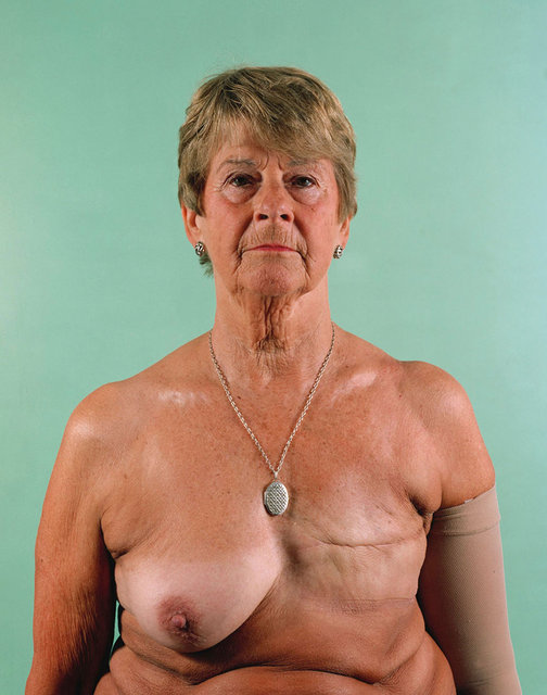 Jean Parker, aged 73.Breast Cancer Series.jpg