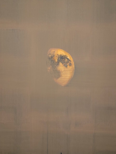 Peter Kohut - It Might Hurt Forever