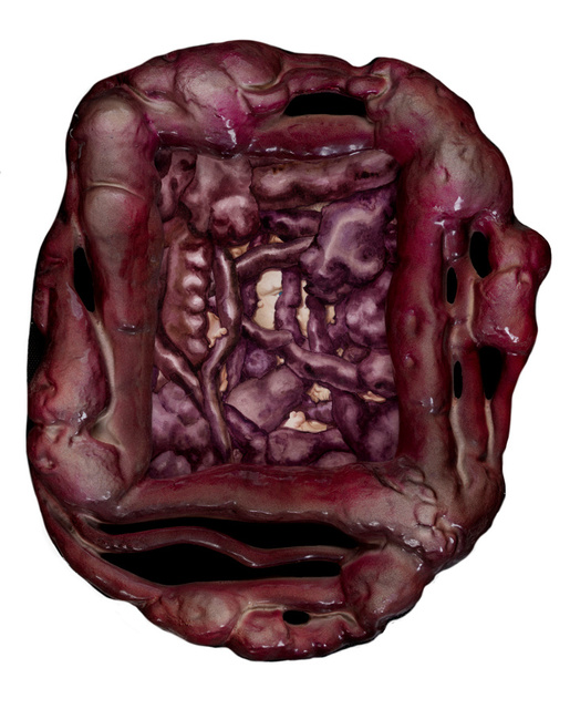 Leper 3