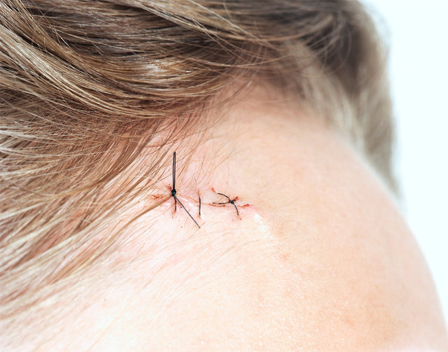Allie-Stitches-close-up-1580-Website.jpg