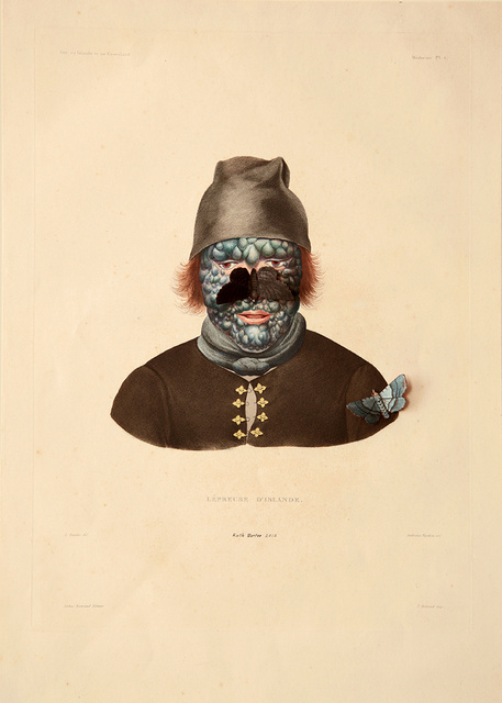 Leper 5