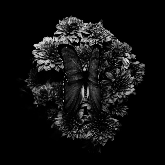 MRI Axial Brain