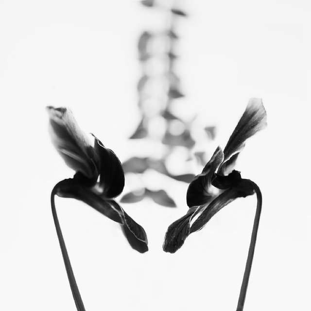Nuclear Medicine Bone Scan, Lumbar Spine and Pelvis