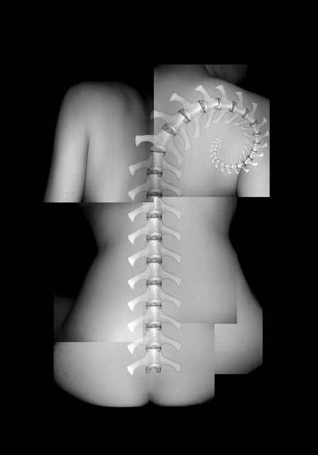 Epidural Space