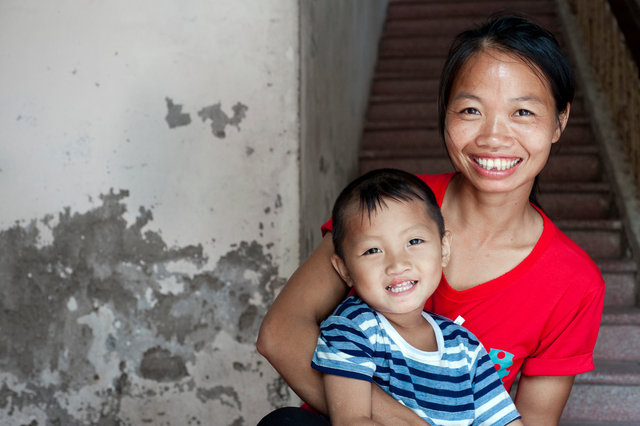 Hanoi, Vietnam. Six months after Surgery