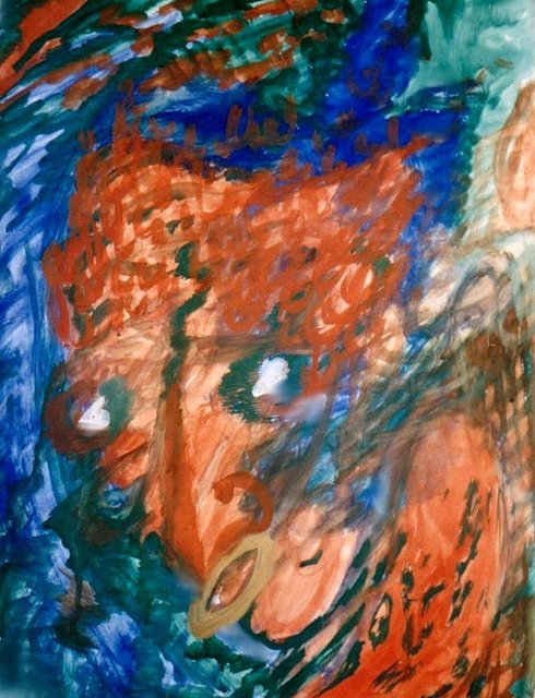 Hodgkin / Cancer 4 (1985)