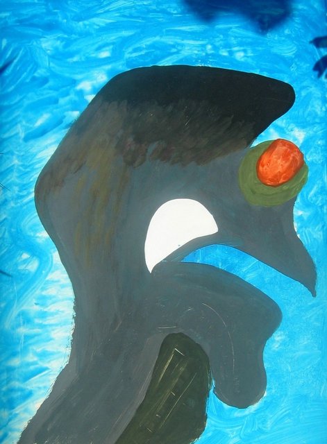 Hodgkin / Cancer (1985)