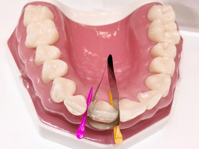 Demonstrationsmodell by CLINICDENT ✓