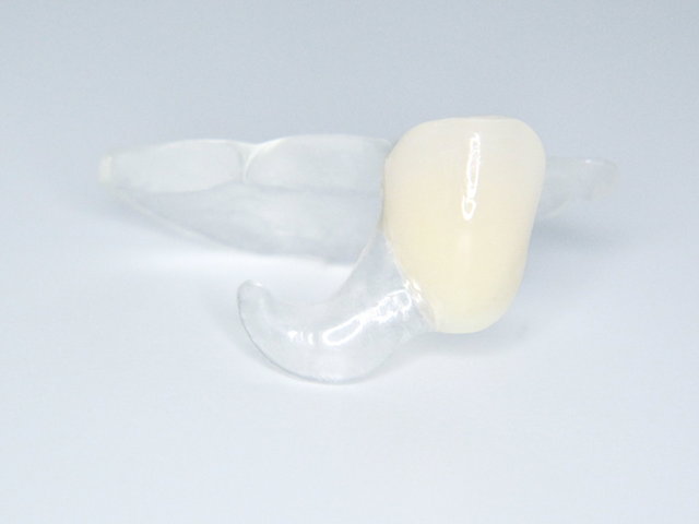 Nylon-Provisorium by CLINICDENT ✓