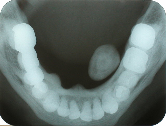 P9154683.JPG