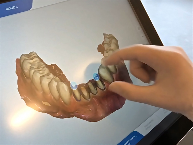 CEREC Primescan (digitale Abformung)