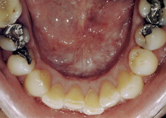 Laserbehandlung by CLINICDENT ✓