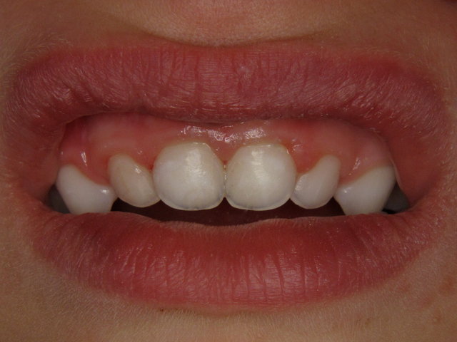 Fertiges Resultat by CLINICDENT ✓