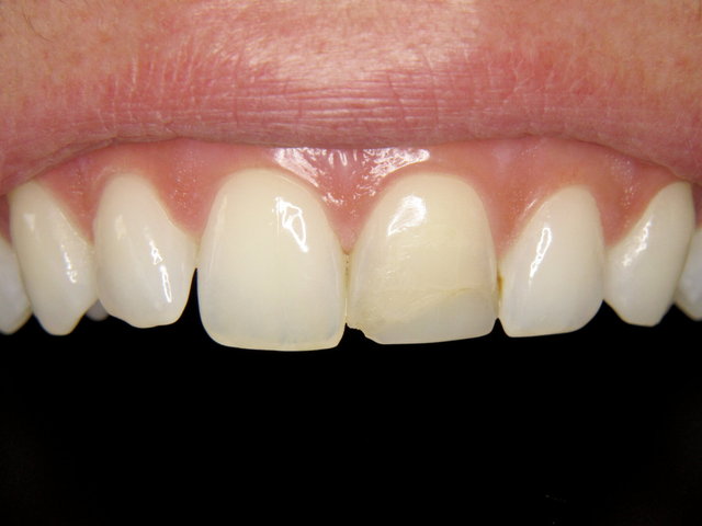 Ästhetisch störend defekter Aufbau ...