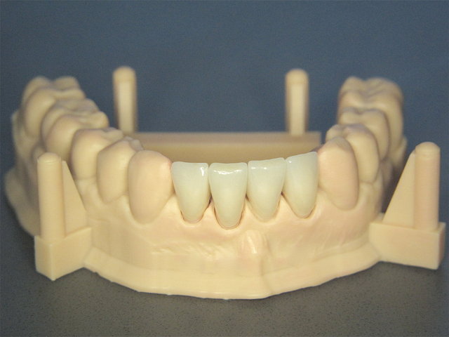 CEREC Primescan (digitale Abformung)