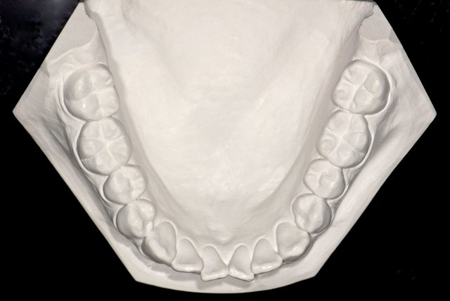 Unterkiefer-Gipsmodell by CLINICDENT ✓