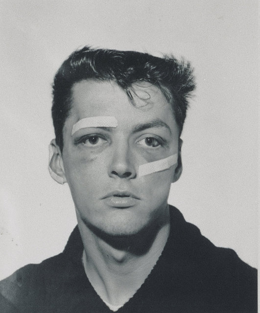 Wounded man detail