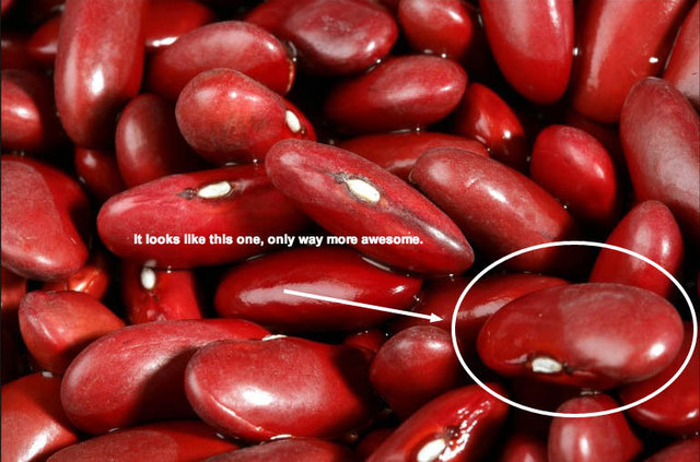 kidney.jpg
