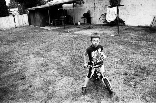 Rasik, with a black eye.