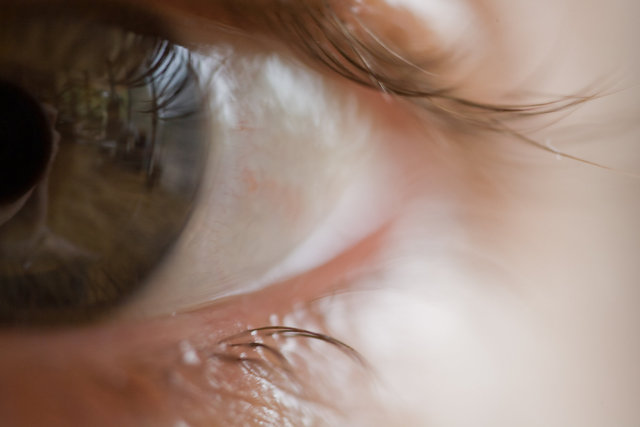 Sight
