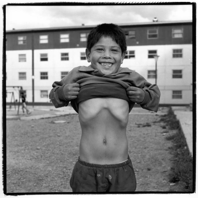 Argen.boy, stomach155.jpg
